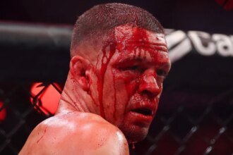 Nate Diaz mocks calls for retirement after losing Mike Perry: 'This shit will last forever'