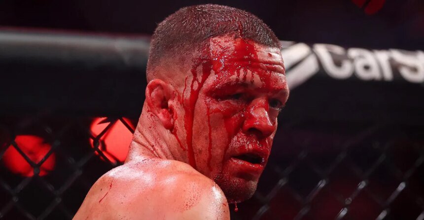 Nate Diaz mocks calls for retirement after losing Mike Perry: 'This shit will last forever'