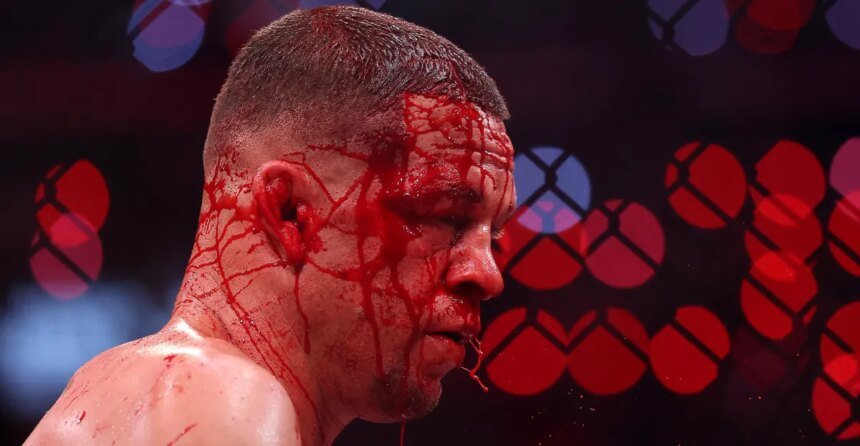 Nate Diaz releases first statement after loss to Mike Perry on Rousey vs. Carano card: 'It's time to kill time'