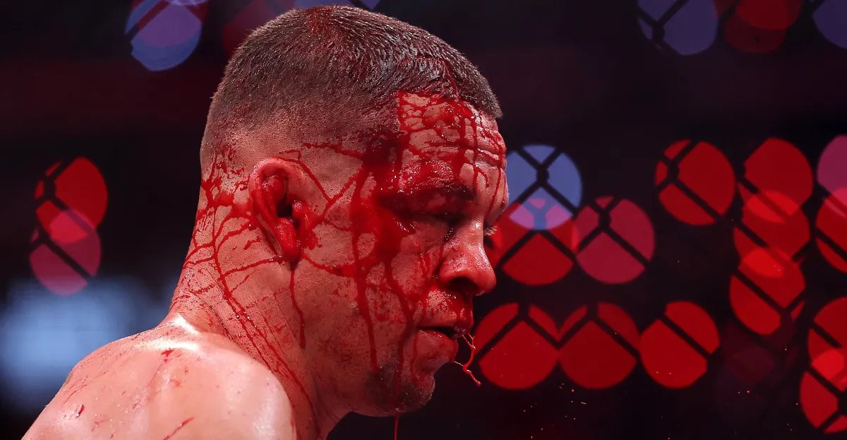 Nate Diaz releases first statement after loss to Mike Perry on Rousey vs. Carano card: 'It's time to kill time'