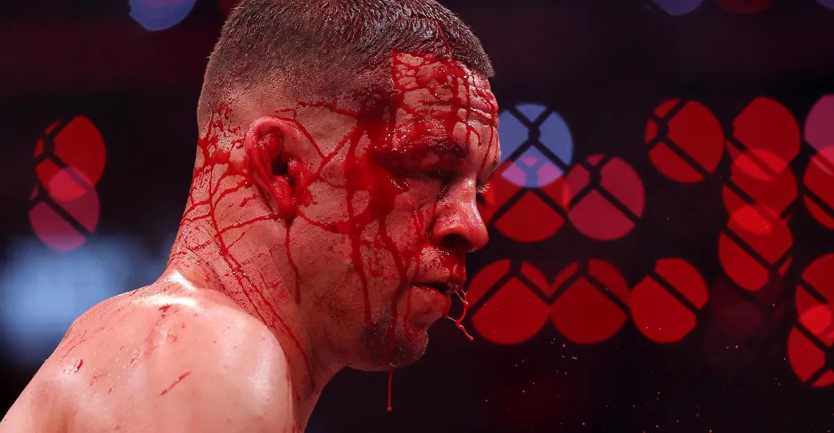 Stitch Duran on Nate Diaz's corner stop against Mike Perry: 'He ended up making 15 staples'