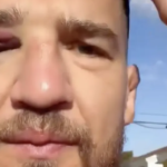 Yaroslav Amosov reveals injury sustained two weeks before his win over Joel Alvarez at UFC 328