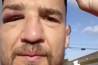 Yaroslav Amosov reveals injury sustained two weeks before his win over Joel Alvarez at UFC 328