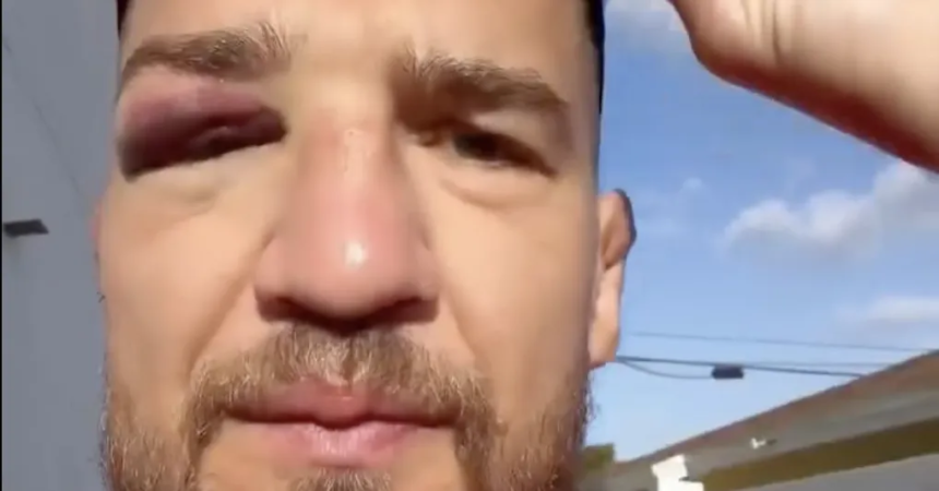 Yaroslav Amosov reveals injury sustained two weeks before his win over Joel Alvarez at UFC 328
