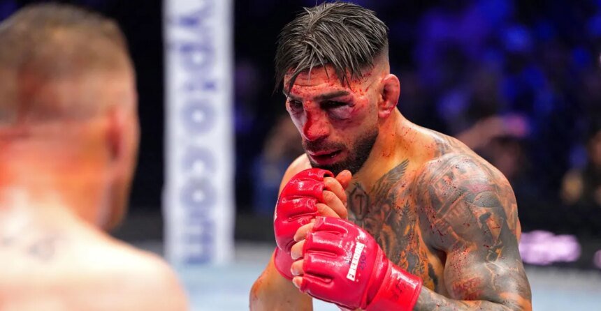 Ilya Topria releases first statement after loss at UFC White House: ``You said you would leave a scar on my face, and you did.''