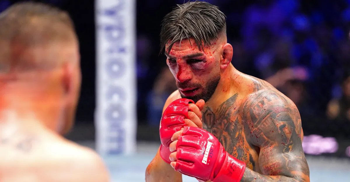 Ilya Topria releases first statement after loss at UFC White House: ``You said you would leave a scar on my face, and you did.''